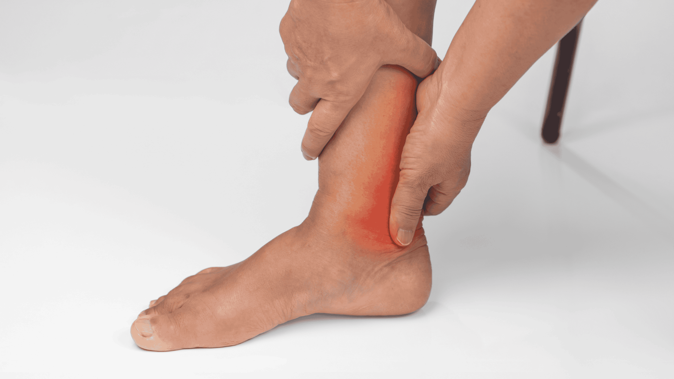 plantar fasciitis