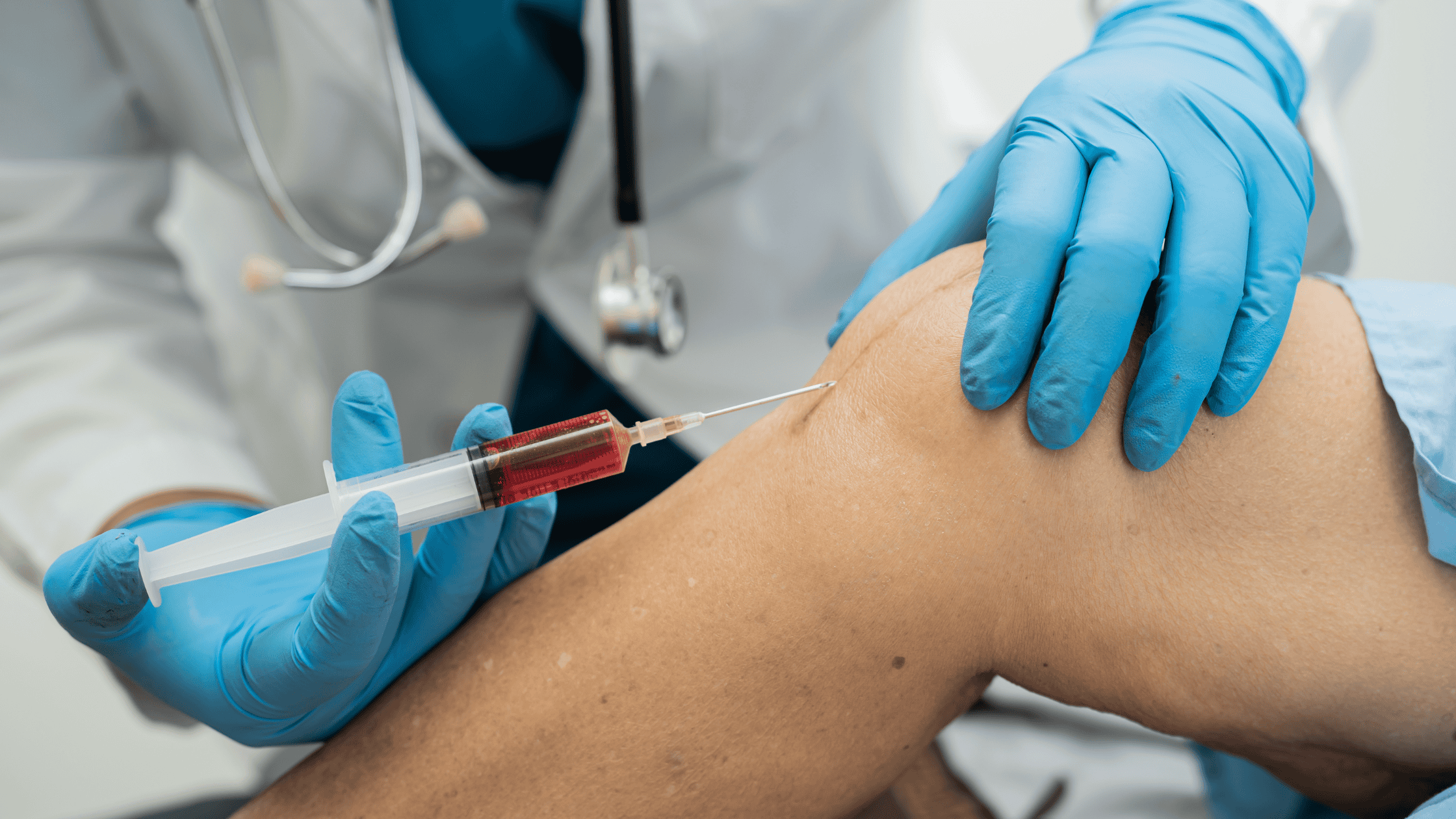 Knee PRP Injection